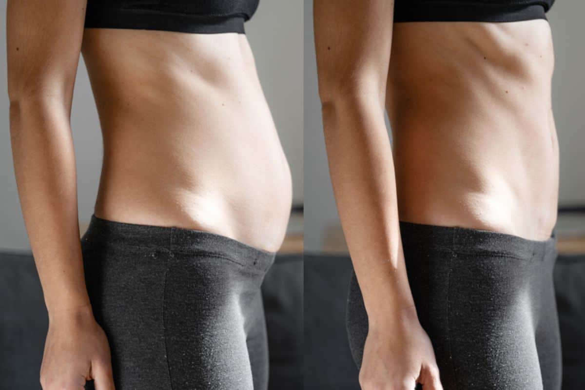 Post-Pregnancy: What Happens to Your Abdominal Muscles After Birth Greater London (Bromley)