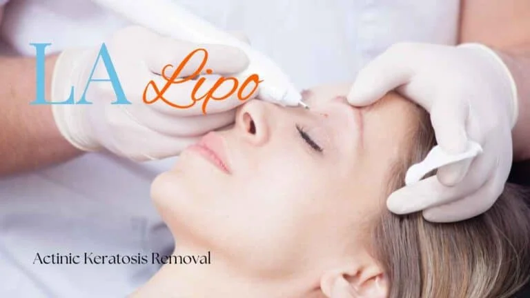 Woman receiving Actinic Keratosis Removal Treatment Greater London (Bromley)