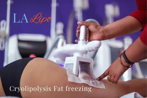 women getting fat freezing Greater London (Bromley)