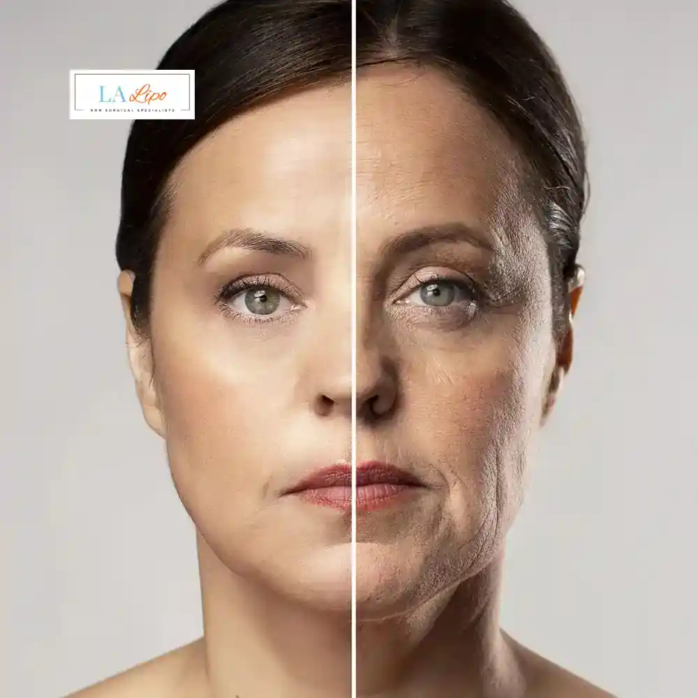 How Can You Tell If Non-Surgical Skin Tightening Is Right for You Greater London (Bromley)?
