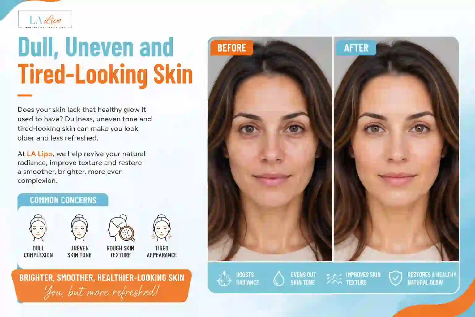 Sign #5: Dull, Uneven and Tired-Looking Skin Greater London (Bromley)