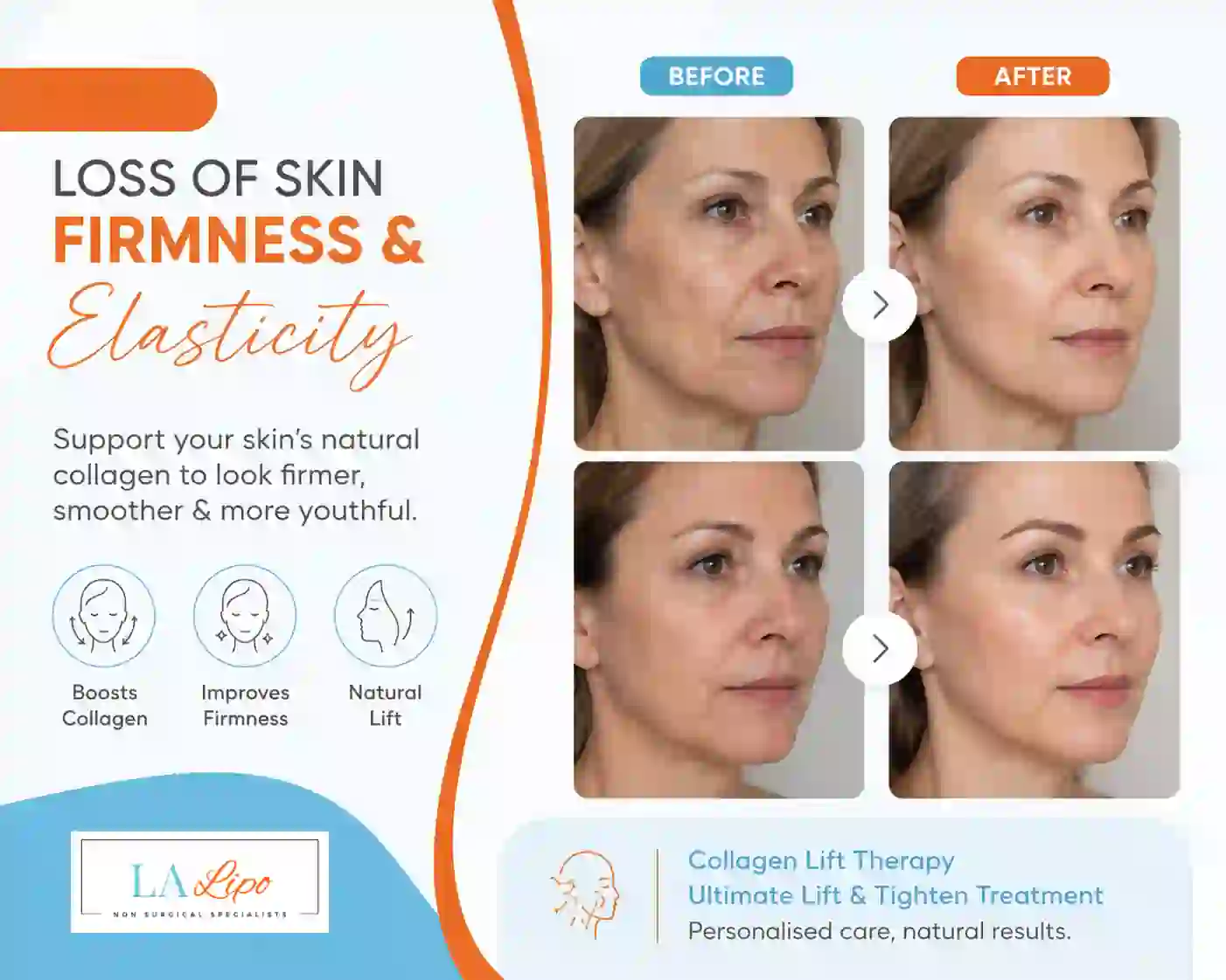 Sign #7: Loss of Skin Firmness and Elasticity Greater London (Bromley)